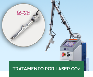 TRATAMENTO POR LASER CO2